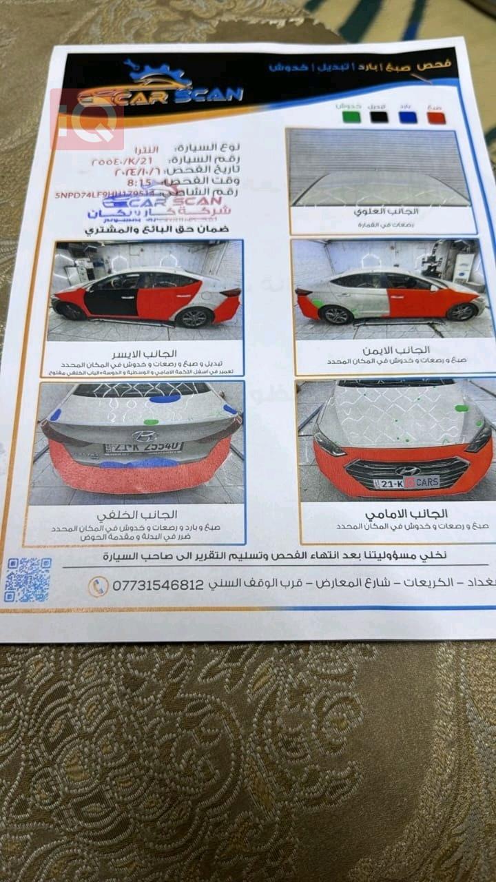 هيونداي النترا